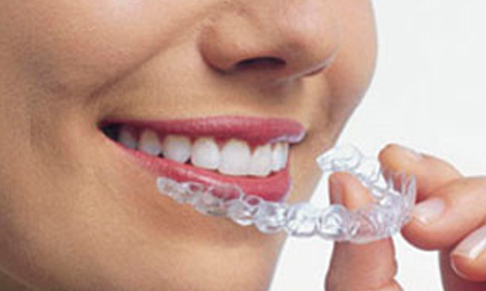 Smiling Face and Hand Holding Invisalign Clear Aligners
